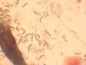 Demodexmilben unterm Mikroskop