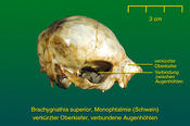 Verkürzter Oberkiefer