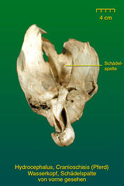 Wasserkopf mit Schädelspalte - Präparat 2