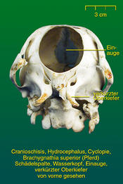 Wasserkopf mit Schädelspalte - Präparat 3