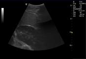 Fig.1: Ultrasonography of the abdominal cavity